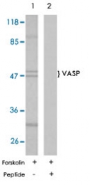 PAB5625 - VASP