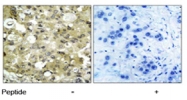 PAB5629 - CD309 / VEGFR-2 / Flk-1