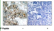 PAB5733 - CD61 / ITGB3