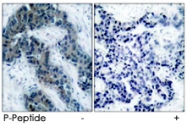 PAB5741 - Tyrosine-protein kinase JAK2