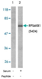 PAB5785 - RPS6KB1 / STK14A