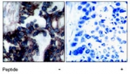 PAB5785 - RPS6KB1 / STK14A