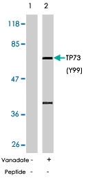 PAB5789 - Tumor protein p73 (TP73)
