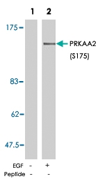 PAB5805 - PRKAA2
