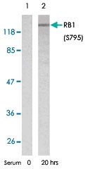 PAB5812 - Retinoblastoma-associated protein / RB1