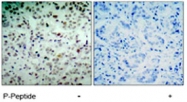 PAB5812 - Retinoblastoma-associated protein / RB1