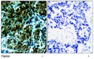 PAB5879 - CTDP1