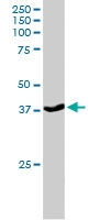 PAB6000 - SEC61A1