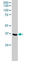 PAB6001 - Bcl-7A