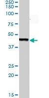 PAB6010 - Aurora kinase A
