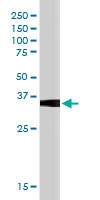 PAB6012 - SOCS1