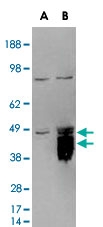 PAB6017 - TFPI