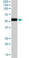 PAB6018 - ALDH1