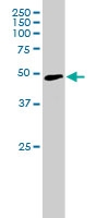 PAB6021 - NCF1