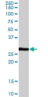 PAB6024 - CDKN1B / KIP1