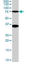 PAB6027 - ORC3 / LATHEO