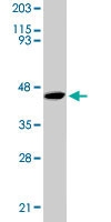 PAB6028 - ORC4