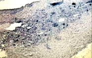 PAB6030 - STAT3