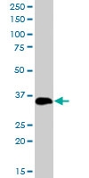 PAB6032 - TXNDC1 / TMX1