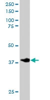 PAB6036 - GRAP2