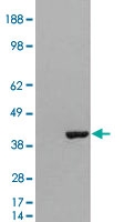 PAB6036 - GRAP2
