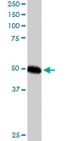 PAB6039 - CSK