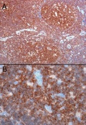 PAB6039 - CSK