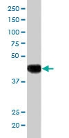 PAB6044 - SLC16A7