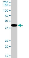 PAB6051 - Endophilin-B1