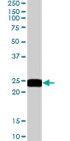 PAB6054 - BAG2