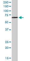PAB6061 - Myotubularin / MTM1