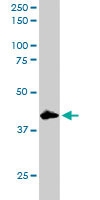 PAB6062 - DUSP1 / MKP1