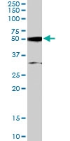 PAB6063 - ATF2