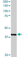 PAB6064 - ABTB1