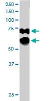 PAB6072 - PPP2R5D