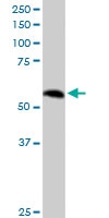 PAB6073 - PPP2R5A