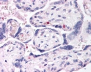 PAB6074 - DUSP16