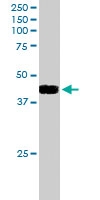 PAB6080 - ATF4