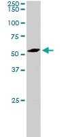 PAB6081 - PLRG1
