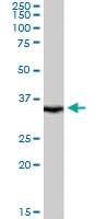 PAB6082 - LASP1