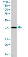 PAB6084 - CRKL