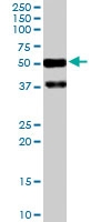 PAB6089 - PACSIN1