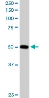 PAB6090 - PACSIN3