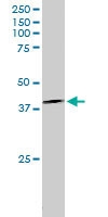 PAB6091 - DAPK2 / DRP-1
