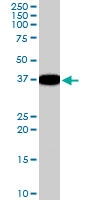 PAB6093 - DDAH1