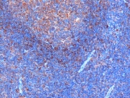 PAB6094 - GRB2 / ASH