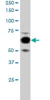 PAB6095 - Cyclooxygenase 1