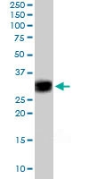 PAB6099 - SIAH1