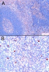 PAB6100 - FOXP3