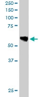 PAB6107 - Annexin A11 / ANXA11